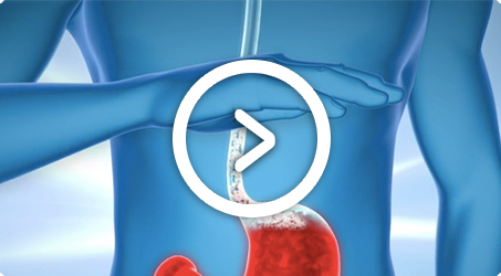 gaviscon acid why reflux works heartburn stomach effectively quickly formula blocks treat learn unique